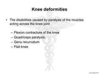 Knee deformities
• The disabilities caused by paralysis of the muscles
acting across the knee joint
– Flexion contracture of the knee
– Quadriceps paralysis.
– Genu recurvatum
– Flail knee
 