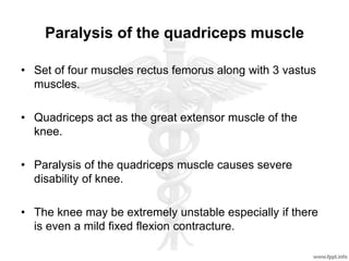 Paralysis of the quadriceps muscle
• Set of four muscles rectus femorus along with 3 vastus
muscles.
• Quadriceps act as the great extensor muscle of the
knee.
• Paralysis of the quadriceps muscle causes severe
disability of knee.
• The knee may be extremely unstable especially if there
is even a mild fixed flexion contracture.
 