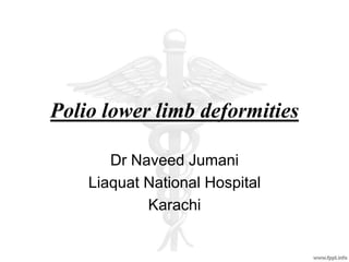 Polio lower limb deformities
Dr Naveed Jumani
Liaquat National Hospital
Karachi
 