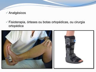  Analgésicos
 Fisioterapia, órteses ou botas ortopédicas, ou cirurgia
ortopédica
 