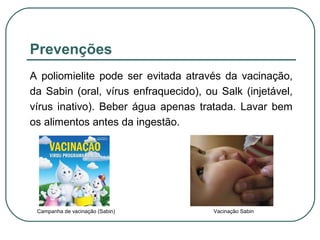 Prevenções
A poliomielite pode ser evitada através da vacinação,
da Sabin (oral, vírus enfraquecido), ou Salk (injetável,
vírus inativo). Beber água apenas tratada. Lavar bem
os alimentos antes da ingestão.
Campanha de vacinação (Sabin) Vacinação Sabin
 