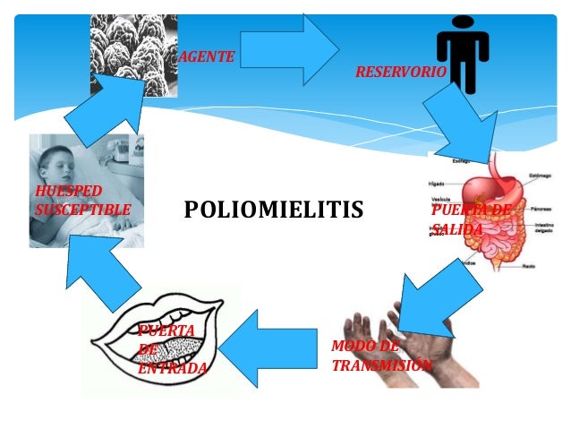 cadena epidemiologica poliomelitis poliomielitis cadena epidemiologica poliomelitis poliomielitis