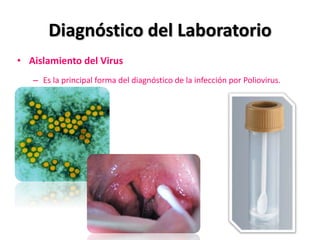 Diagnóstico del Laboratorio
• Aislamiento del Virus
– Es la principal forma del diagnóstico de la infección por Poliovirus.
 