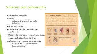 • 30-40 años después
• 30-40%
• poliomielitis paralítica en la
infancia
• Dolor muscular
• Exacerbación de la debilidad
existente
• Desarrollar paresia o parálisisnuevas.
• cepas salvajes de poliovirus.
• Afectación residual permanente
• Después de la recuperación
• Sexo femenino.
Síndrome post-poliomielitis
 