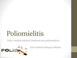 Poliomielitis
Polio, Parálisis infantil, Síndrome pos poliomielítico
Itzel Gabriela Márquez Molina

 