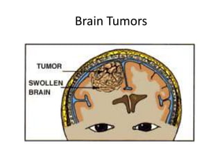 Symptoms:	CHARACTERISED BY THE FOLLOWING:abnormal muscle tone, posture (i.e. slouching over while sitting), reflexes, or motor development and coordination. 
