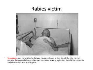 Bites from a rabid animal (an animal with rabies) are the most common way in which rabies transmission occurs. Non-bite exposure and human-to-human exposure are both rare.