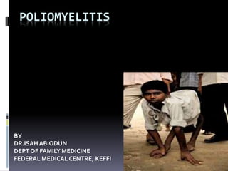 POLIOMYELITIS
BY
DR.ISAHABIODUN
DEPT OF FAMILY MEDICINE
FEDERAL MEDICAL CENTRE, KEFFI
 