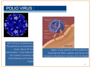 Left: Picture of poliovirus.
The poliovirus is extremely
small, about 50 nm
(nanometer = one-billionth
of a meter) Courtesy of
David Belnap and James
Hogle
Right: Cross-section of the poliovirus
showing the RNA, capsid, and nerve cell
receptors Illustration courtesy of Link Studio
24
 