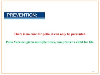 There is no cure for polio, it can only be prevented.
Polio Vaccine, given multiple times, can protect a child for life.
30
 
