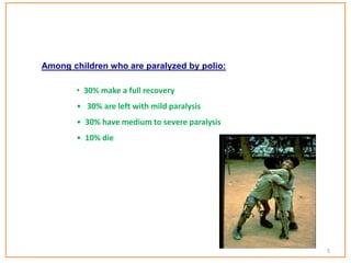 Among children who are paralyzed by polio:
• 30% make a full recovery
• 30% are left with mild paralysis
• 30% have medium to severe paralysis
• 10% die
5
 