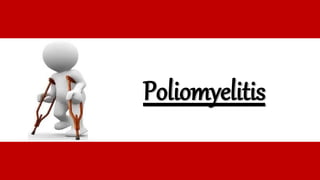 Poliomyelitis
 