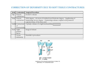 CORRECTION OF DEFORMITY DUE TO SOFT TISSUE CONTRACTURES
 