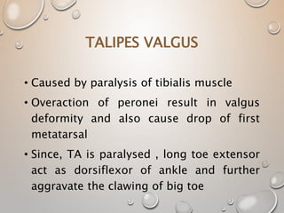 TALIPES VALGUS
• Caused by paralysis of tibialis muscle
• Overaction of peronei result in valgus
deformity and also cause drop of first
metatarsal
• Since, TA is paralysed , long toe extensor
act as dorsiflexor of ankle and further
aggravate the clawing of big toe
 