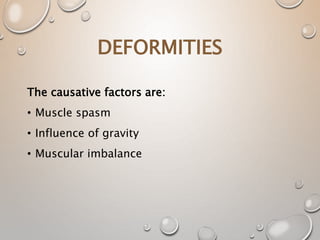 The causative factors are:
• Muscle spasm
• Influence of gravity
• Muscular imbalance
DEFORMITIES
 
