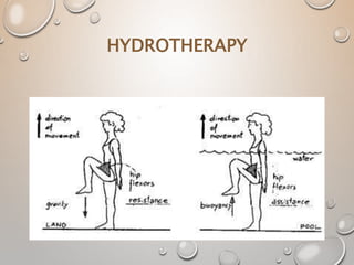 HYDROTHERAPY
 