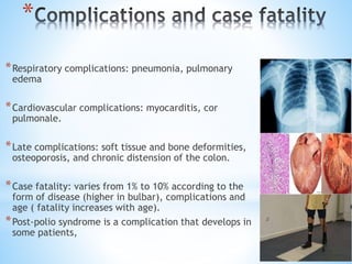 *
*Respiratory complications: pneumonia, pulmonary
edema
*Cardiovascular complications: myocarditis, cor
pulmonale.
*Late complications: soft tissue and bone deformities,
osteoporosis, and chronic distension of the colon.
*Case fatality: varies from 1% to 10% according to the
form of disease (higher in bulbar), complications and
age ( fatality increases with age).
*Post-polio syndrome is a complication that develops in
some patients,
 