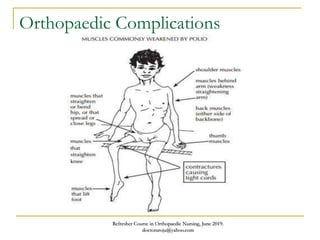 Orthopaedic Complications
Refresher Course in Orthopaedic Nursing, June 2019.
doctoraroju@yahoo.com
 