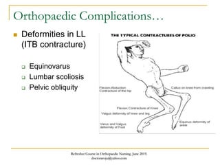 Orthopaedic Complications…
 Deformities in LL
(ITB contracture)
 Equinovarus
 Lumbar scoliosis
 Pelvic obliquity
Refresher Course in Orthopaedic Nursing, June 2019.
doctoraroju@yahoo.com
 