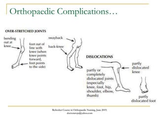 Orthopaedic Complications…
Refresher Course in Orthopaedic Nursing, June 2019.
doctoraroju@yahoo.com
 