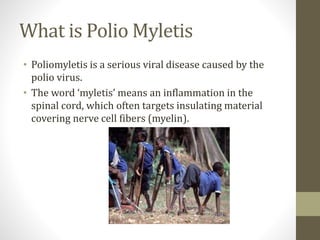 What is Polio Myletis
• Poliomyletis is a serious viral disease caused by the
polio virus.
• The word ‘myletis’ means an inflammation in the
spinal cord, which often targets insulating material
covering nerve cell fibers (myelin).
 