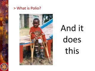 > What is Polio?




                   And it
                   does
                    this
 