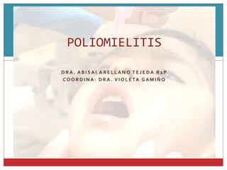 Polio, Rabia, Tétanos | PPTX