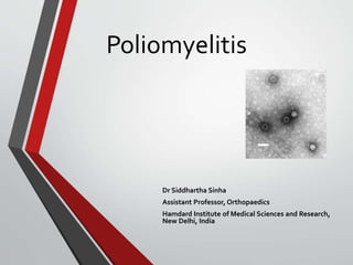 Poliomyelitis
Dr Siddhartha Sinha
Assistant Professor, Orthopaedics
Hamdard Institute of Medical Sciences and Research,
New Delhi, India
 