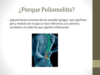 ¿Porque Poliomelitis?
• popularmente proviene de los vocablos griegos que significan
gris y medula con lo que se hace referencia a la columna
vertebral y el sufijo itis que significa inflamación
 