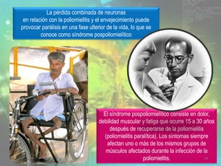 La pérdida combinada de neuronas
en relación con la poliomielitis y el envejecimiento puede
provocar parálisis en una fase ulterior de la vida, lo que se
conoce como síndrome pospoliomielítico
El síndrome pospoliomielítico consiste en dolor,
debilidad muscular y fatiga que ocurre 15 a 30 años
después de recuperarse de la poliomielitis
(poliomielitis paralítica). Los síntomas siempre
afectan uno o más de los mismos grupos de
músculos afectados durante la infección de la
poliomielitis. 24
 