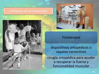 Limitacion de la incapacidad
Fisioterapia
dispositivos ortopédicos o
zapatos correctivos
cirugía ortopédica para ayudar
a recuperar la fuerza y
funcionalidad muscular
30
 