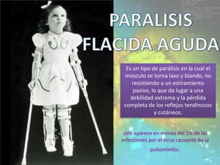 Es un tipo de parálisis en la cual el
músculo se torna laxo y blando, no
resistiendo a un estiramiento
pasivo, lo que da lugar a una
debilidad extrema y la pérdida
completa de los reflejos tendinosos
y cutáneos.
sólo aparece en menos del 1% de las
infecciones por el virus causante de la
poliomielitis.
32
 