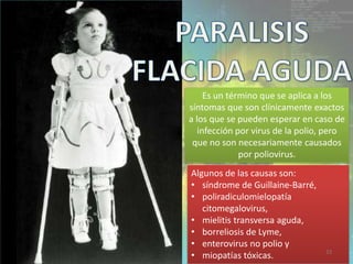 Es un término que se aplica a los
síntomas que son clínicamente exactos
a los que se pueden esperar en caso de
infección por virus de la polio, pero
que no son necesariamente causados
por poliovirus.
Algunos de las causas son:
• síndrome de Guillaine-Barré,
• poliradiculomielopatía
citomegalovirus,
• mielitis transversa aguda,
• borreliosis de Lyme,
• enterovirus no polio y
• miopatías tóxicas. 33
 