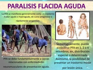 PFA se debe fundamentalmente a causas
relacionadas con enfermedades
neuromusculares de presentación aguda.
Semiológicamente, puede
padecerse PFA en 1, 2 o 4
miembros, en, distribución
especial o determinada
Asimismo, la posibilidad de
presentar un trastorno motor
por lesión única.
La PFA se manifiesta generalmente como un trastorno
motor agudo o hiperagudo, de curso progresivo o
rápidamente progresivo.
34
 