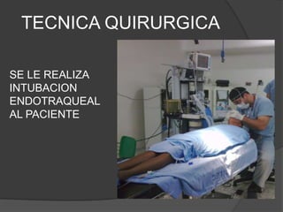 TECNICA QUIRURGICA
SE LE REALIZA
INTUBACION
ENDOTRAQUEAL
AL PACIENTE
 