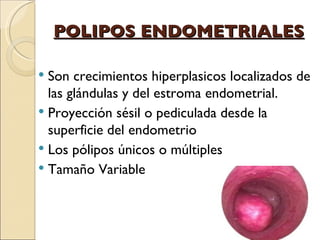 POLIPOS ENDOMETRIALES Son crecimientos hiperplasicos localizados de las glándulas y del estroma endometrial. Proyección sésil o pediculada desde la superficie del endometrio Los pólipos únicos o múltiples Tamaño Variable 