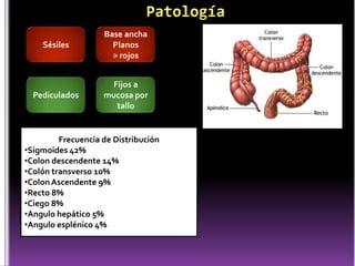 Sésiles
Pediculados
Base ancha
Planos
> rojos
Fijos a
mucosa por
tallo
Frecuencia de Distribución
•Sigmoides 42%
•Colon descendente 14%
•Colón transverso 10%
•Colon Ascendente 9%
•Recto 8%
•Ciego 8%
•Angulo hepático 5%
•Angulo esplénico 4%
 