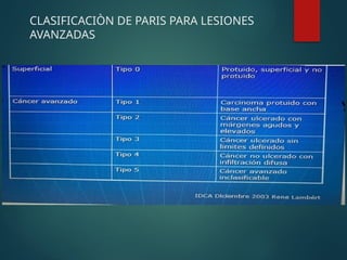 CLASIFICACIÒN DE PARIS PARA LESIONES
AVANZADAS
 
