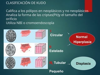 CLASIFICACIÒN DE KUDO
Califica a los pólipos en neoplásicos y no neoplásicos
Analiza la forma de las criptas(Pit)y el tamaño del
orificio
Utiliza NBI o cromoendoscopìa
I
Circular
II
Estelado
IIIL Tubular
Pequeño
Normal
Hiperplasia
Displasia
 