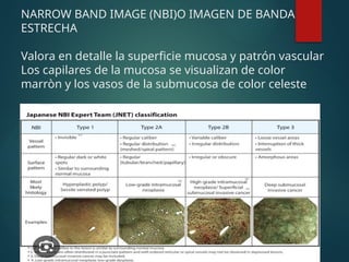 NARROW BAND IMAGE (NBI)O IMAGEN DE BANDA
ESTRECHA
Valora en detalle la superficie mucosa y patrón vascular
Los capilares de la mucosa se visualizan de color
marròn y los vasos de la submucosa de color celeste
 
