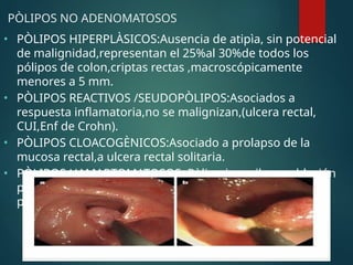 PÒLIPOS NO ADENOMATOSOS
• PÒLIPOS HIPERPLÀSICOS:Ausencia de atipìa, sin potencial
de malignidad,representan el 25%al 30%de todos los
pólipos de colon,criptas rectas ,macroscópicamente
menores a 5 mm.
• PÒLIPOS REACTIVOS /SEUDOPÒLIPOS:Asociados a
respuesta inflamatoria,no se malignizan,(ulcera rectal,
CUI,Enf de Crohn).
• PÒLIPOS CLOACOGÈNICOS:Asociado a prolapso de la
mucosa rectal,a ulcera rectal solitaria.
• PÒLIPOS HAMARTOMATOSOS :Pòlipo juvenil,en población
pediàtrica,solitario y generalmente
pediculado,hematoquezia.
 