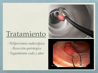 P lipos De Colon Y Recto PDF p-lipos-de-colon-y-recto-pdf