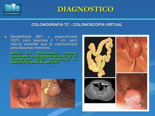H. “LLUÍS ALCANYÍS”
DIAGNOSTICO
 Sensibilidad 88% y especificidad
100% para lesiones ≥ 1 cm, pero
menos sensible que la colonoscopia
para lesiones menores.
Mulhall, G.R. "Meta-Analysis: Computed
Tomographic Colonography."Accuracy of CT
Colonography (Virtual Colonoscopy) for
Detecting Polyps A.I.M. April 2005
COLONOGRAFIA TC - COLONOSCOPIA VIRTUAL
 