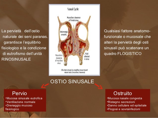 La poliposi nasale