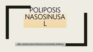 POLIPOSIS
NASOSINUSA
L
MR1: BANDA BALTODANOALEXANDRA XIMENA
 