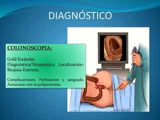DIAGNÓSTICO
COLONOSCOPIA:
Gold Estándar.
Diagnóstica/Terapéutica: Localización-
Biopsia-Exéresis.
Complicaciones: Perforación y sangrado.
Aumentan con la polipectomía.
 