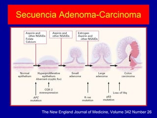 Secuencia Adenoma-Carcinoma The New England Journal of Medicine, Volume 342 Number 26 