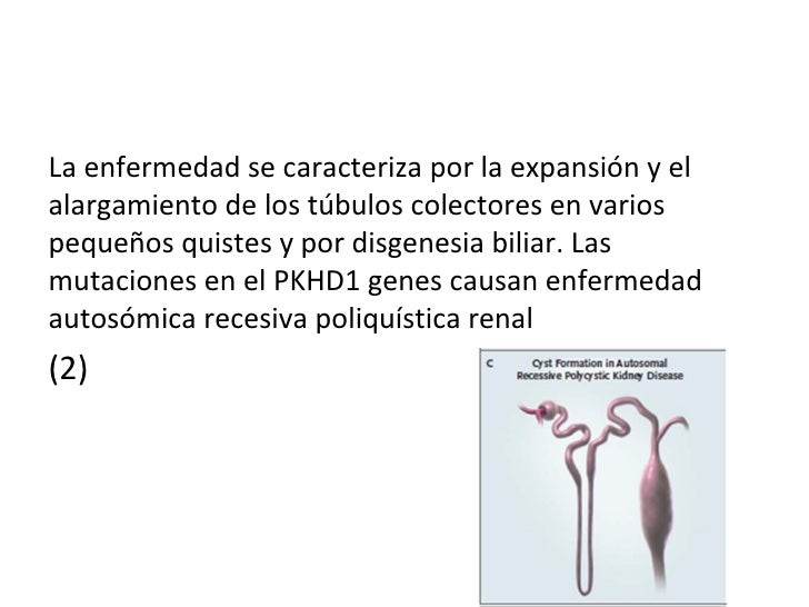 Que mejor ungüento de sheynogo de la osteocondrosis