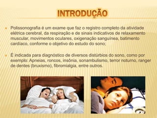  Polissonografia é um exame que faz o registro completo da atividade 
elétrica cerebral, da respiração e de sinais indicativos de relaxamento 
muscular, movimentos oculares, oxigenação sanguínea, batimento 
cardíaco, conforme o objetivo do estudo do sono; 
 É indicada para diagnóstico de diversos distúrbios do sono, como por 
exemplo: Apneias, roncos, insônia, sonambulismo, terror noturno, ranger 
de dentes (bruxismo), fibromialgia, entre outros. 
 