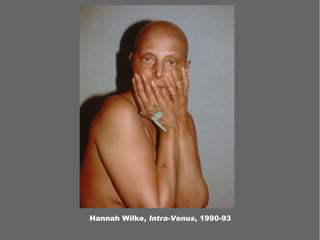 Hannah Wilke, Intra-Venus, 1990-93
 